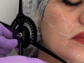 aesthetic-injection-filler aesthetic and beauty services with AI facial analysis